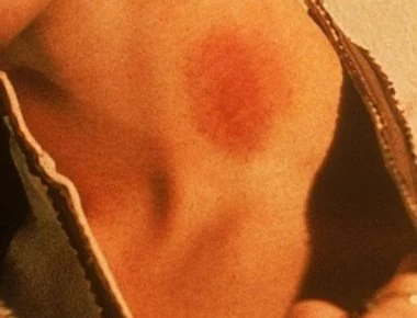 Έτσι εξαφανίζονται τα... σημάδια στο λαιμό